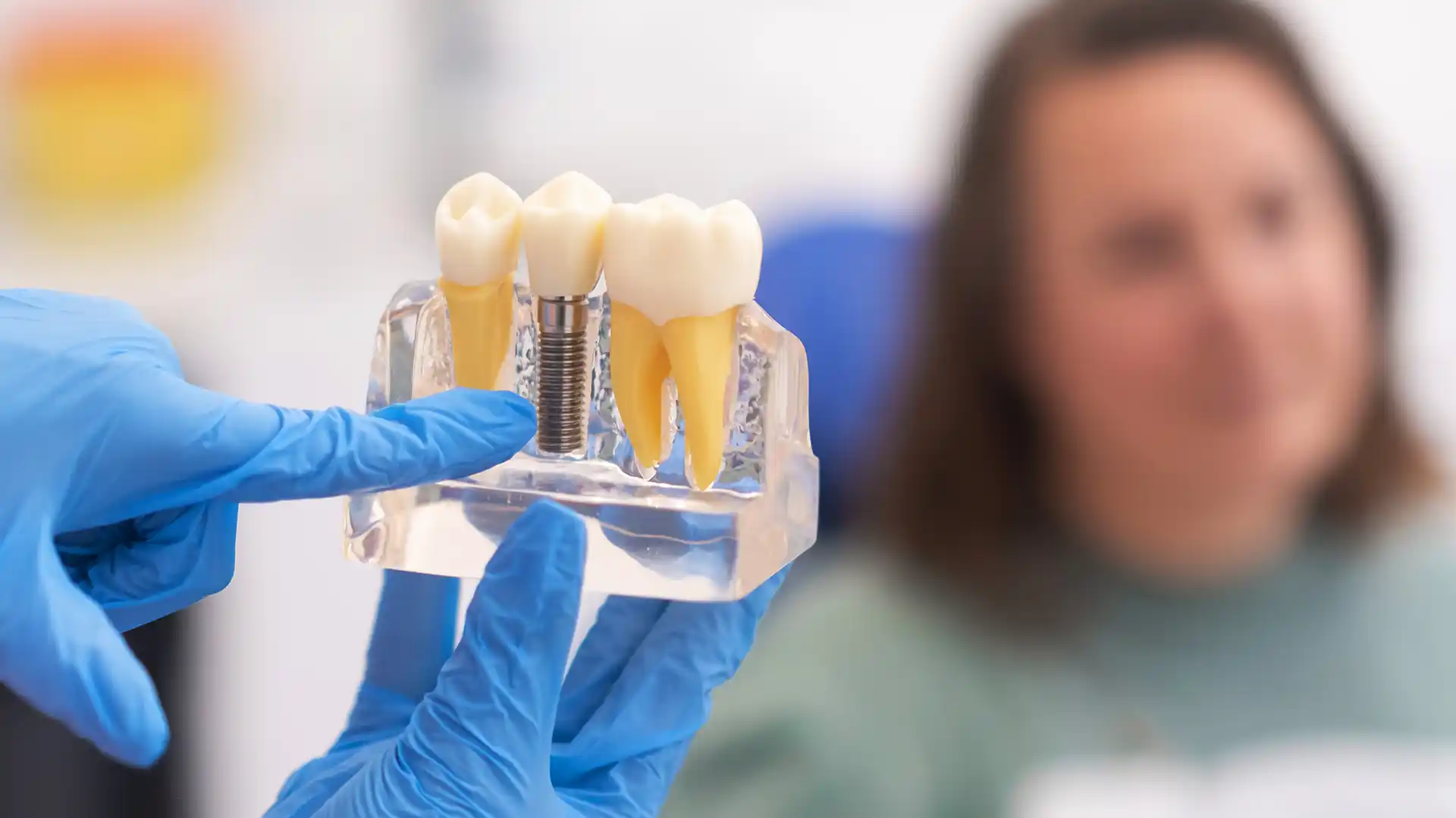 All-on-6 dental implants Turkey
